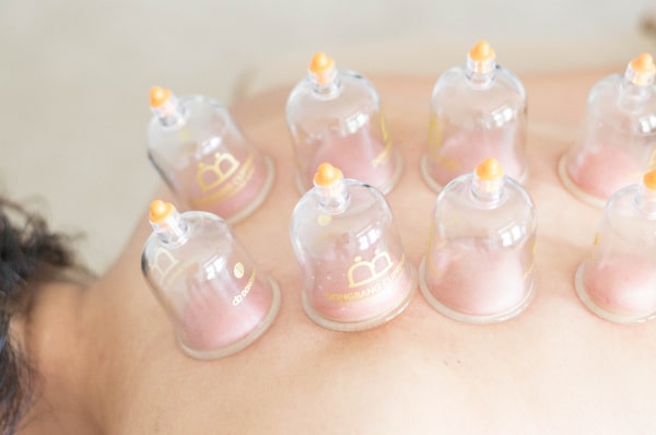 cupping therapy-min